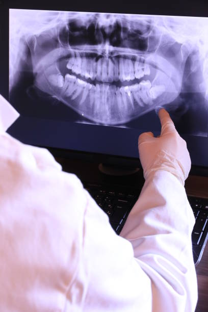 Best Emergency Root Canal Therapy in South Charleston, WV