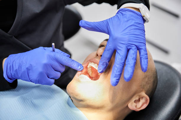 Best Knocked-Out Tooth (Avulsed Tooth) Treatment in South Charleston, WV